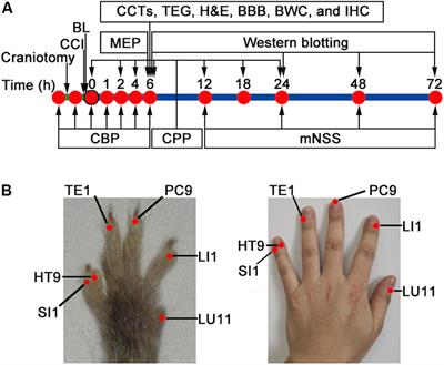 Bloodletting Puncture at Hand Twelve Jing-Well Points Improves Neurological Recovery by Ameliorating Acute Traumatic Brain Injury-Induced Coagulopathy in Mice